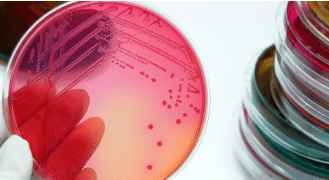 Chlorine that kills escherichia coli